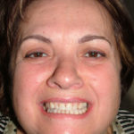 Gina - Birchmount Dental Group in Scarborough