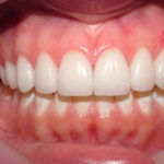 Agnes - Birchmount Dental Group in Scarborough
