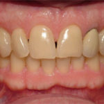 Jason - Birchmount Dental Group in Scarborough