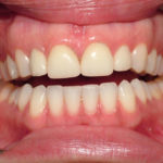 Jennifer - Birchmount Dental Group in Scarborough