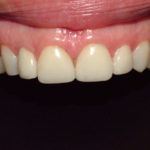 Jennifer - Birchmount Dental Group in Scarborough