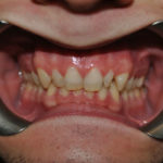 Milos - Birchmount Dental Group in Scarborough