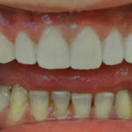 Milos - Birchmount Dental Group in Scarborough